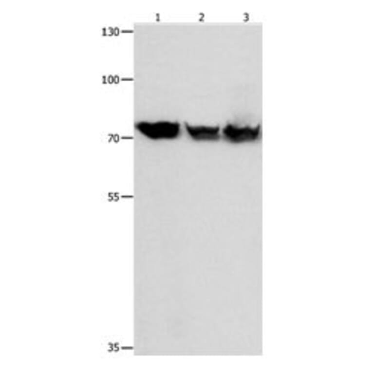 TRAP1 Antibody from Signalway Antibody (31085) - Antibodies.com