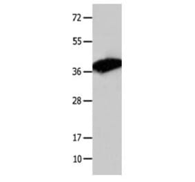 COPS5 Antibody from Signalway Antibody (31092) - Antibodies.com