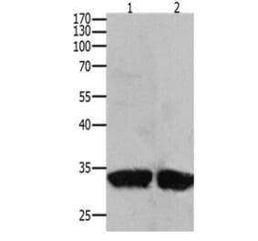 BIRC7 Antibody from Signalway Antibody (31094) - Antibodies.com
