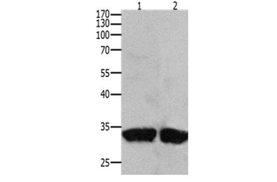 BIRC7 Antibody from Signalway Antibody (31094) - Antibodies.com