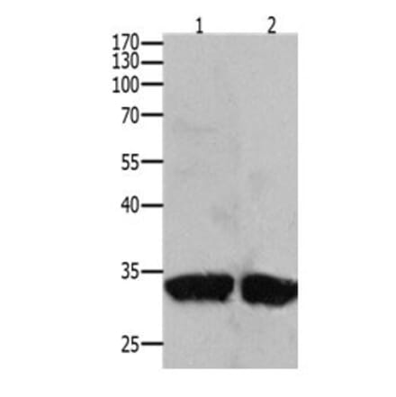 BIRC7 Antibody from Signalway Antibody (31094) - Antibodies.com