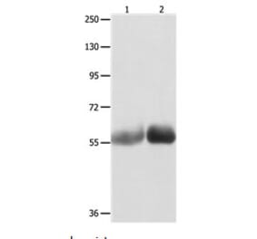 MUTYH Antibody from Signalway Antibody (31101) - Antibodies.com