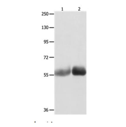 MUTYH Antibody from Signalway Antibody (31101) - Antibodies.com