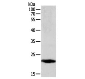PTGDS Antibody from Signalway Antibody (31107) - Antibodies.com