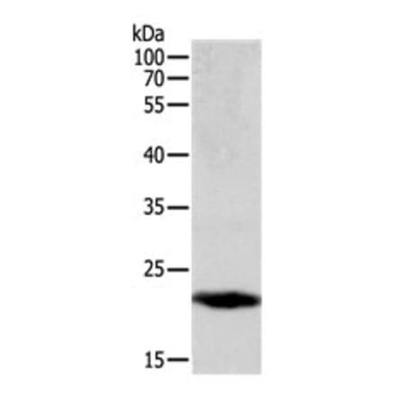 PTGDS Antibody from Signalway Antibody (31107) - Antibodies.com