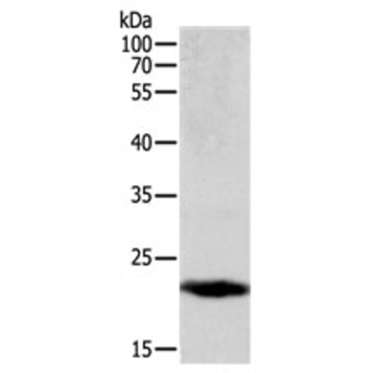 PTGDS Antibody from Signalway Antibody (31107) - Antibodies.com
