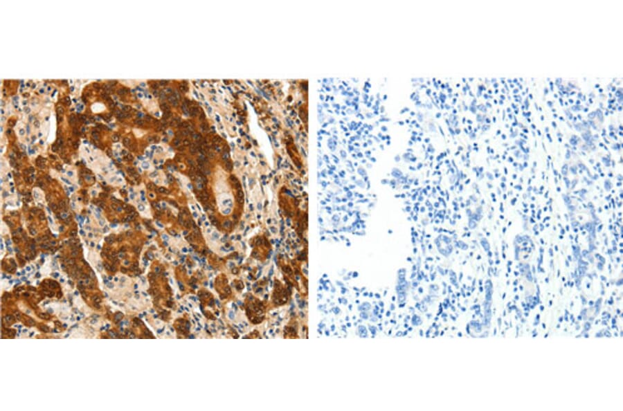 PTGDS Antibody from Signalway Antibody (31107) - Antibodies.com