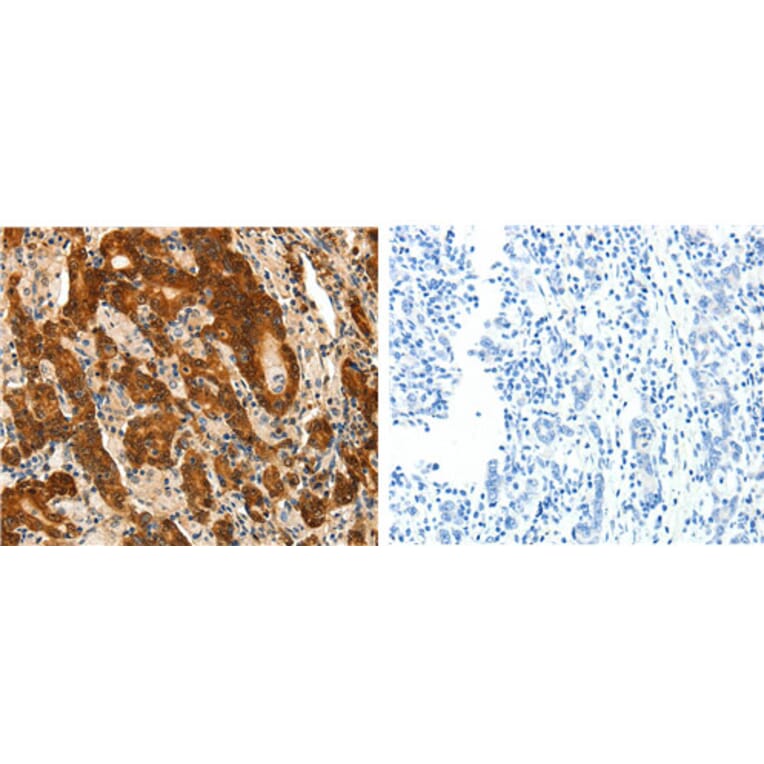 PTGDS Antibody from Signalway Antibody (31107) - Antibodies.com