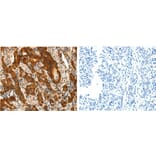 PTGDS Antibody from Signalway Antibody (31107) - Antibodies.com