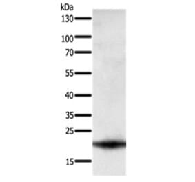 PARK7 Antibody from Signalway Antibody (31108) - Antibodies.com