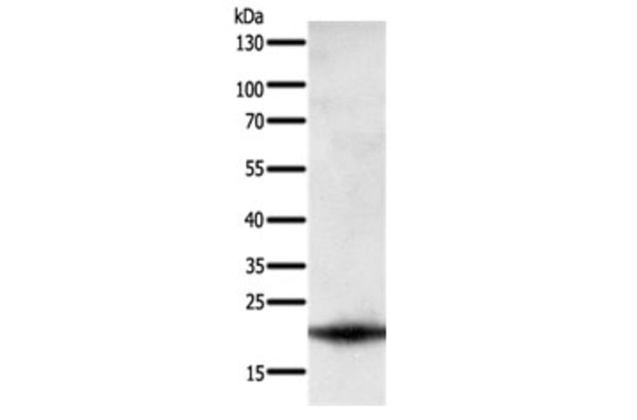 PARK7 Antibody from Signalway Antibody (31108) - Antibodies.com