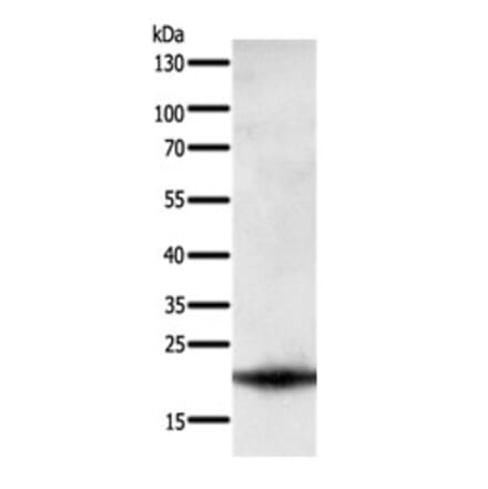 PARK7 Antibody from Signalway Antibody (31108) - Antibodies.com