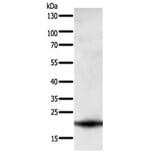 PARK7 Antibody from Signalway Antibody (31108) - Antibodies.com