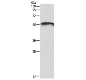 CDH23 Antibody from Signalway Antibody (31109) - Antibodies.com