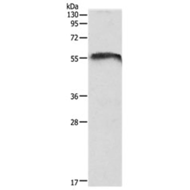 CDH23 Antibody from Signalway Antibody (31109) - Antibodies.com