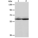 PSMD3 Antibody from Signalway Antibody (31119) - Antibodies.com