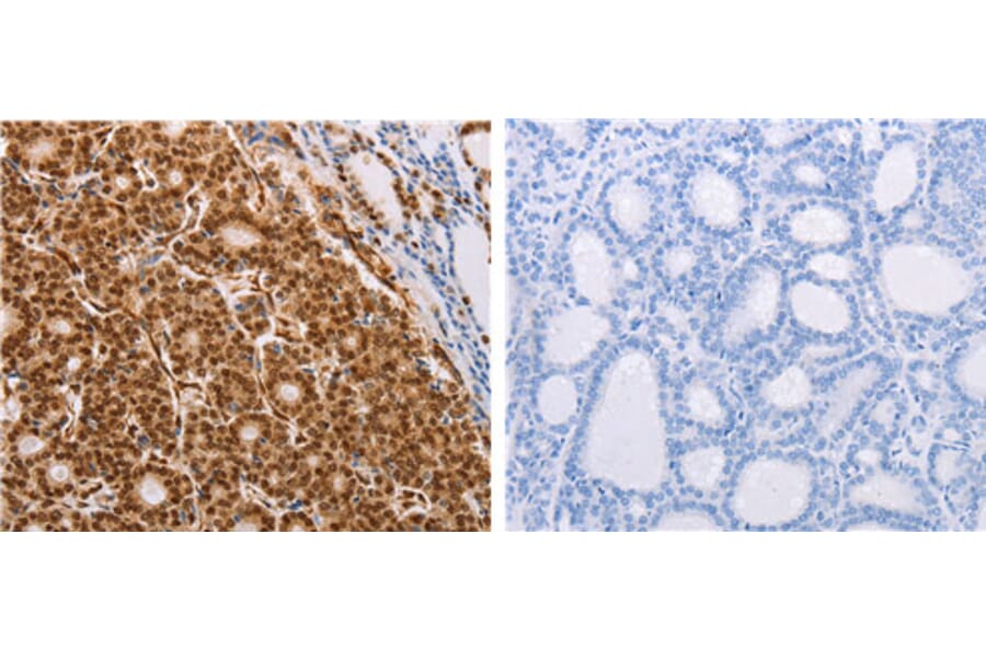 PSMD3 Antibody from Signalway Antibody (31119) - Antibodies.com