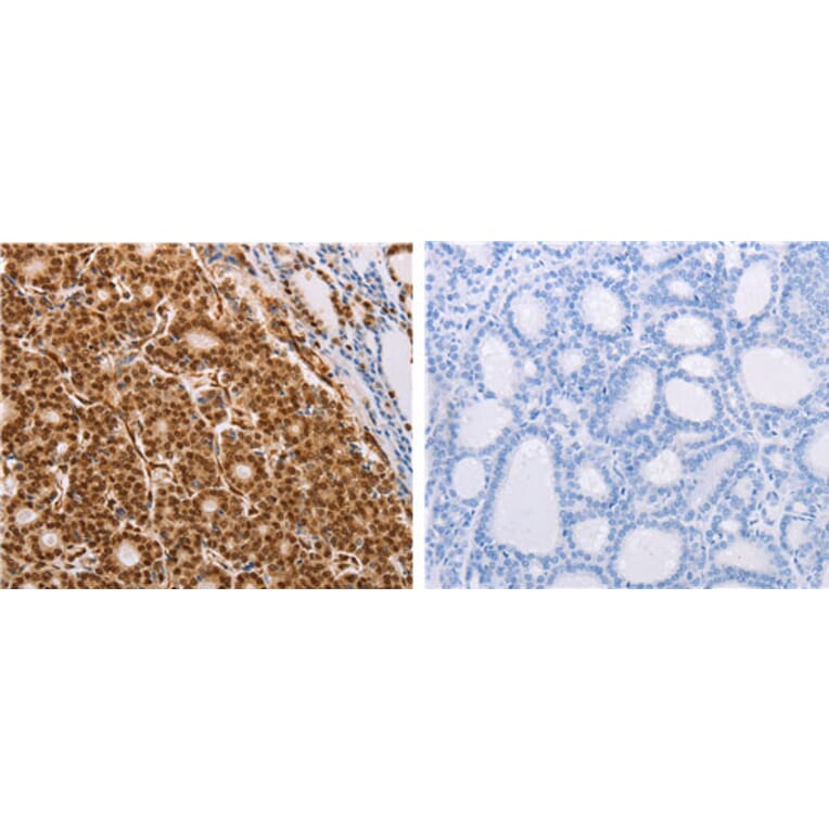 PSMD3 Antibody from Signalway Antibody (31119) - Antibodies.com