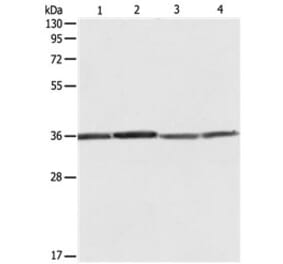 RPLP0 Antibody from Signalway Antibody (31121) - Antibodies.com