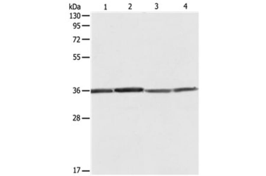 RPLP0 Antibody from Signalway Antibody (31121) - Antibodies.com