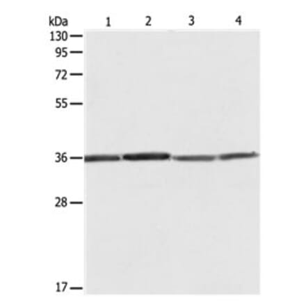 RPLP0 Antibody from Signalway Antibody (31121) - Antibodies.com
