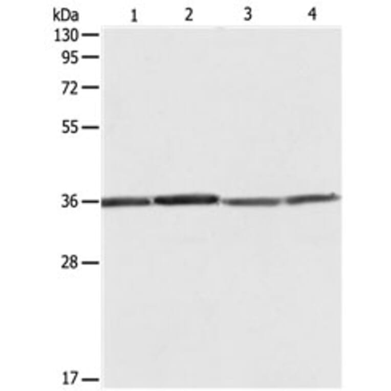 RPLP0 Antibody from Signalway Antibody (31121) - Antibodies.com