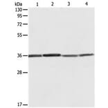 RPLP0 Antibody from Signalway Antibody (31121) - Antibodies.com