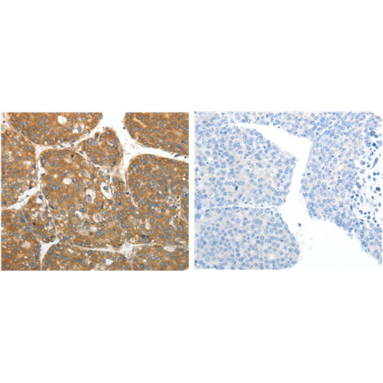 RPLP0 Antibody from Signalway Antibody (31121) - Antibodies.com