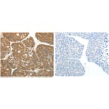RPLP0 Antibody from Signalway Antibody (31121) - Antibodies.com