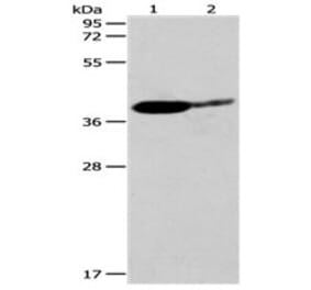 SIRT3 Antibody from Signalway Antibody (31123) - Antibodies.com