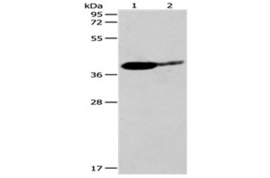 SIRT3 Antibody from Signalway Antibody (31123) - Antibodies.com