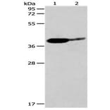 SIRT3 Antibody from Signalway Antibody (31123) - Antibodies.com