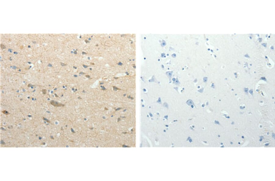 SIRT3 Antibody from Signalway Antibody (31123) - Antibodies.com