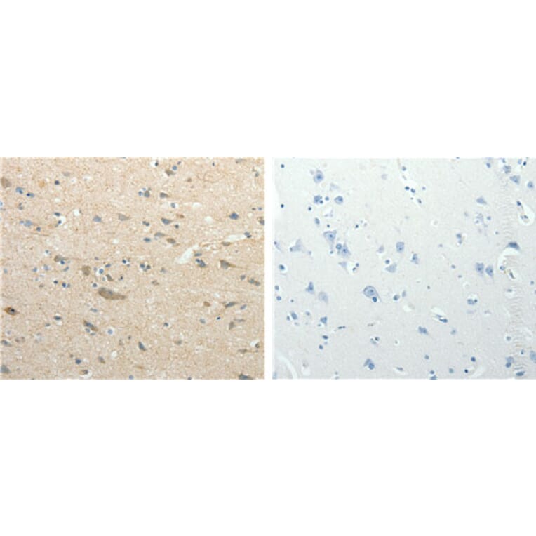 SIRT3 Antibody from Signalway Antibody (31123) - Antibodies.com