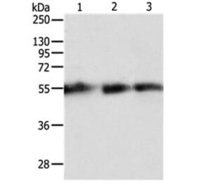 TEKT5 Antibody from Signalway Antibody (31135) - Antibodies.com