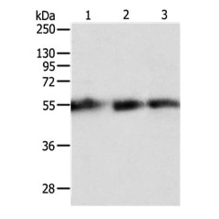 TEKT5 Antibody from Signalway Antibody (31135) - Antibodies.com