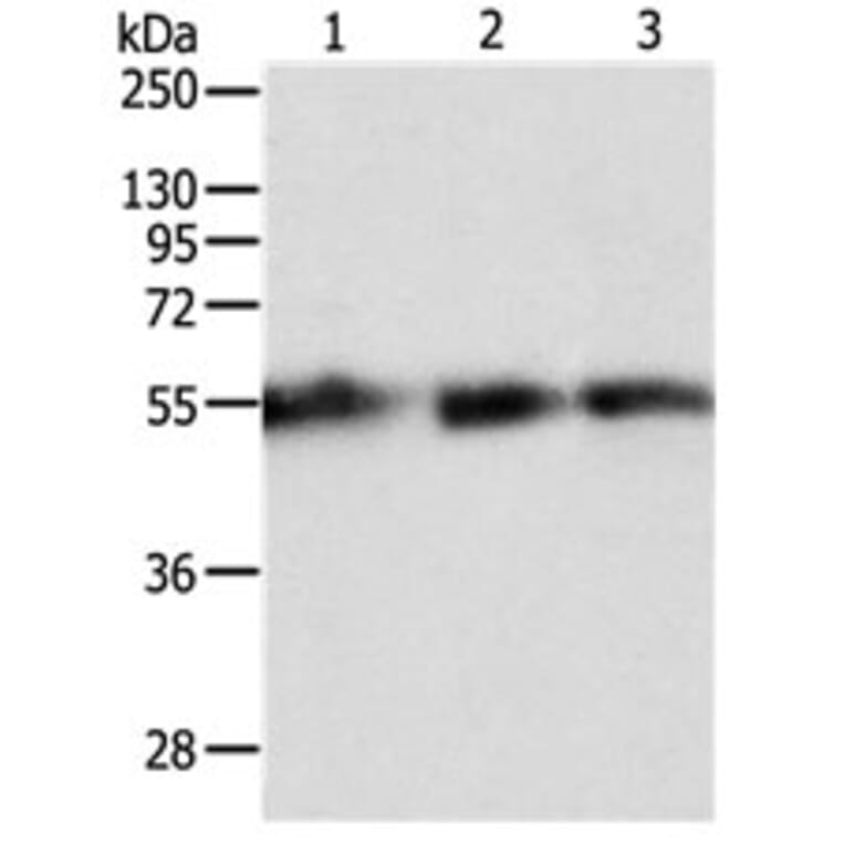 TEKT5 Antibody from Signalway Antibody (31135) - Antibodies.com