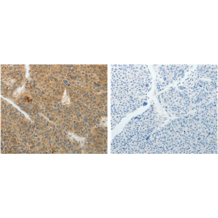 TEKT5 Antibody from Signalway Antibody (31135) - Antibodies.com