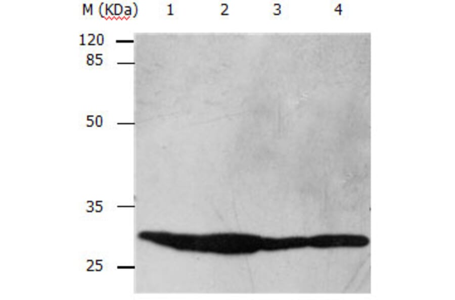YWHAB Antibody from Signalway Antibody (31138) - Antibodies.com