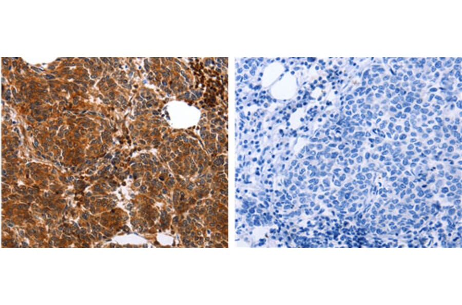 YWHAB Antibody from Signalway Antibody (31138) - Antibodies.com