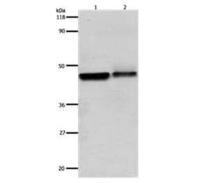 ADRB2 Antibody from Signalway Antibody (31142) - Antibodies.com