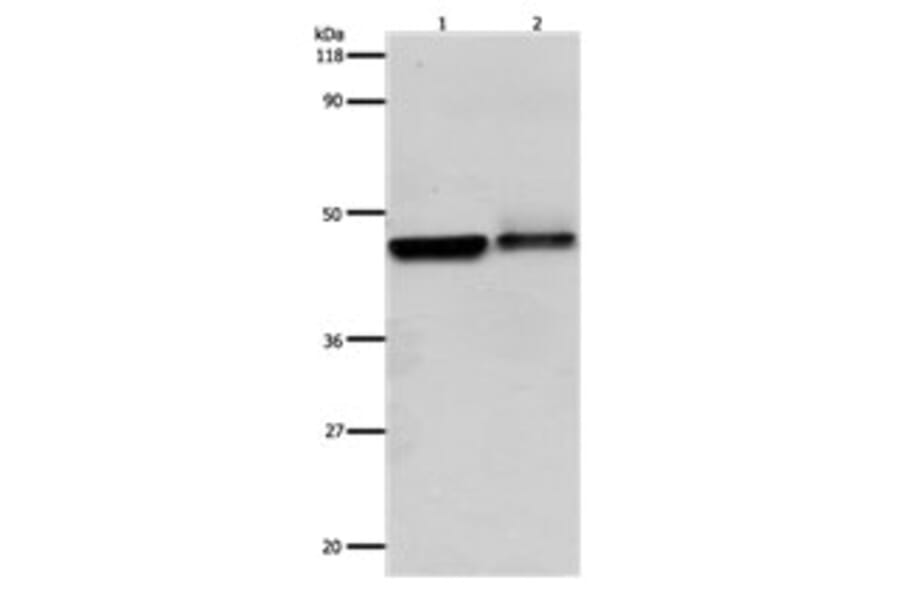 ADRB2 Antibody from Signalway Antibody (31142) - Antibodies.com