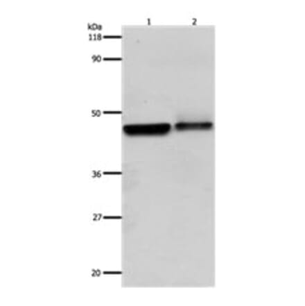 ADRB2 Antibody from Signalway Antibody (31142) - Antibodies.com