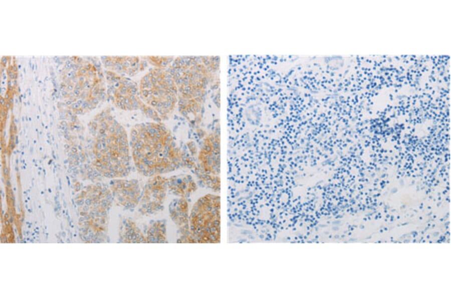 ADRB2 Antibody from Signalway Antibody (31142) - Antibodies.com