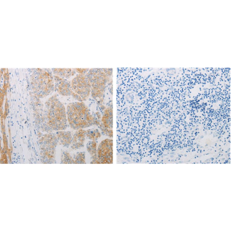 ADRB2 Antibody from Signalway Antibody (31142) - Antibodies.com