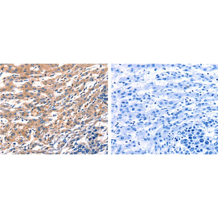 RAB18 Antibody from Signalway Antibody (31143) - Antibodies.com