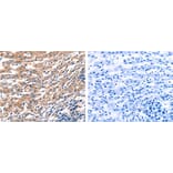 RAB18 Antibody from Signalway Antibody (31143) - Antibodies.com