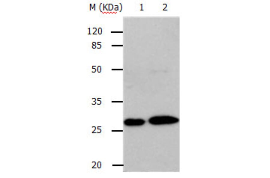 RAB3c Antibody from Signalway Antibody (31148) - Antibodies.com