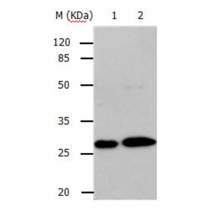 RAB3c Antibody from Signalway Antibody (31148) - Antibodies.com