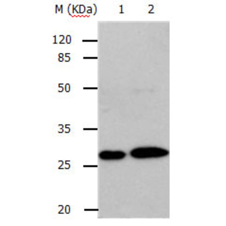 RAB3c Antibody from Signalway Antibody (31148) - Antibodies.com
